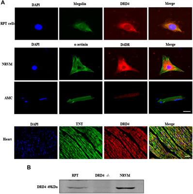 DRD4 Mitigates Myocardial Ischemia/Reperfusion Injury in Association With PI3K/AKT Mediated Glucose Metabolism